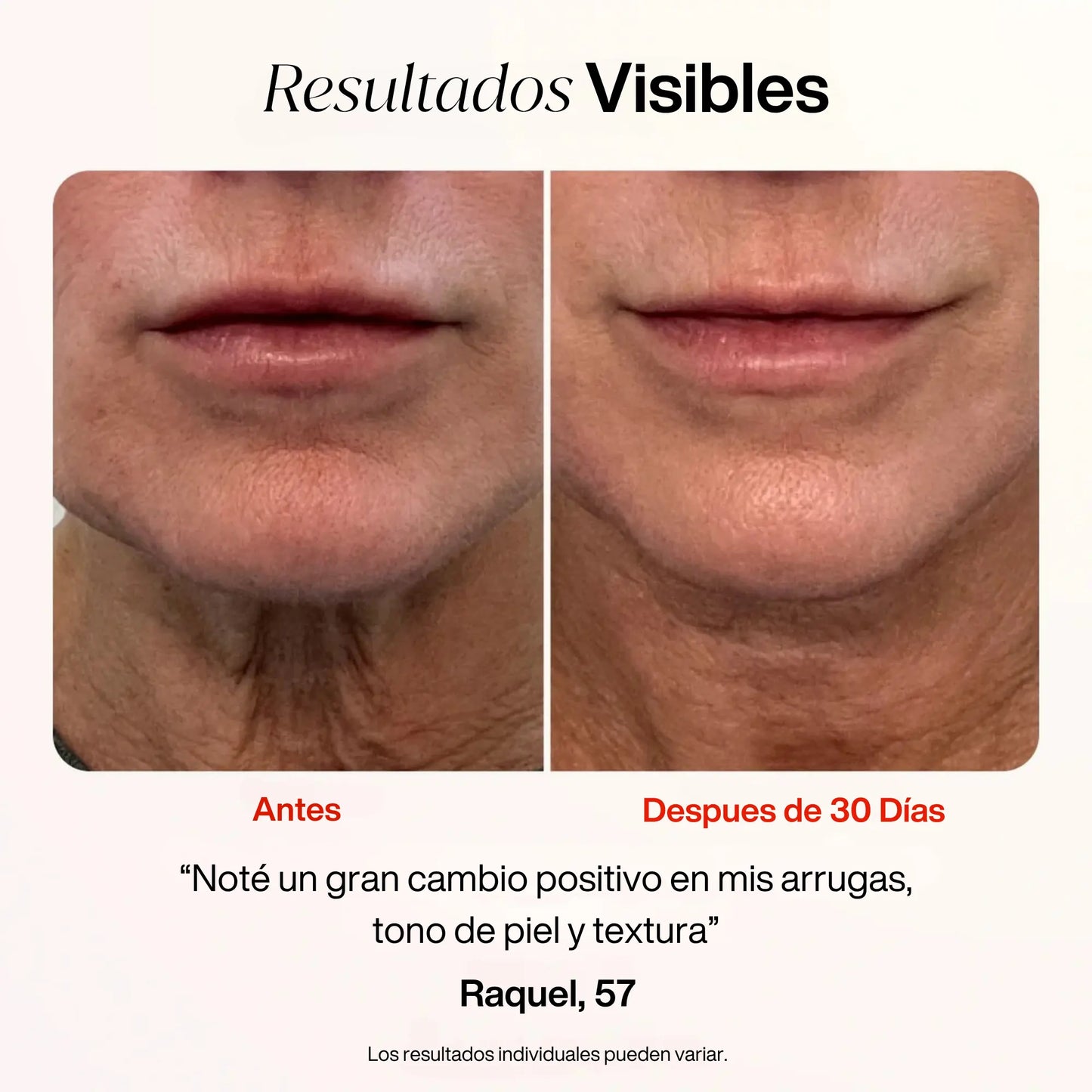 Skin Glow™ - Varita Rejuvenecedora de Luz Roja 4-en-1