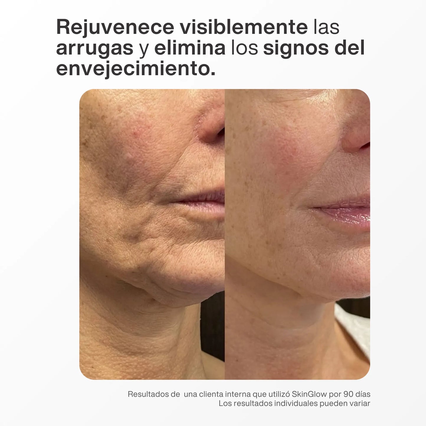 Skin Glow™ - Varita Rejuvenecedora de Luz Roja 4-en-1