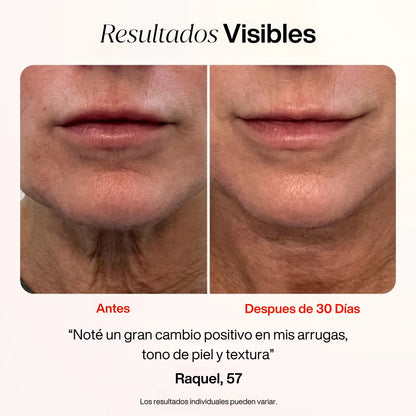 Skin Glow™ - Varita Rejuvenecedora de Luz Roja 4-en-1